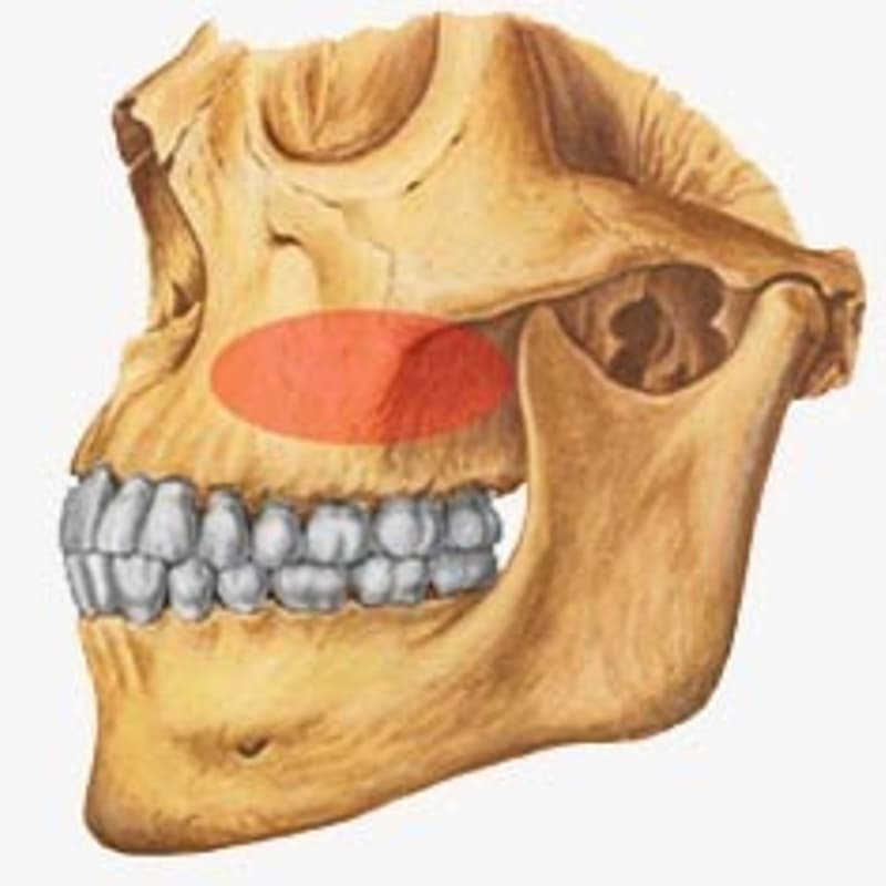 Sinus maxillaris